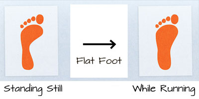 flat foot while running