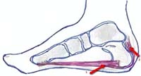 location of condition in foot